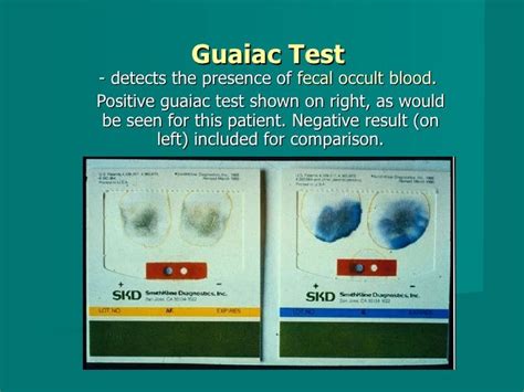 icd 10 code for positive guaiac stool test